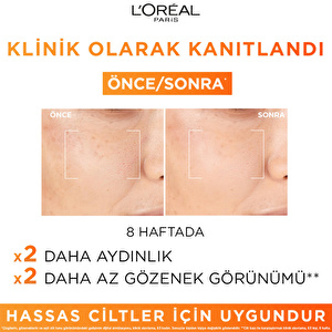 L'Oréal Paris Revitalift Clinical %12 Saf C Vitamini Aydınlatıcı Serum 30ml