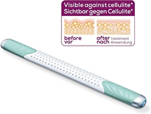 BEURER CM 100 Cellulite ReleaZER Selülit Masaj Cihazı