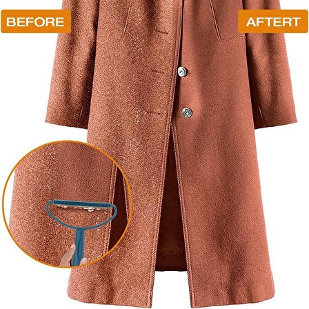 3B Trend Çift Taraflı Elbise Tiftik ve Tüy Toparlayıcı Tarak Kazak Hırka Halı Kumaş Tüy Alma