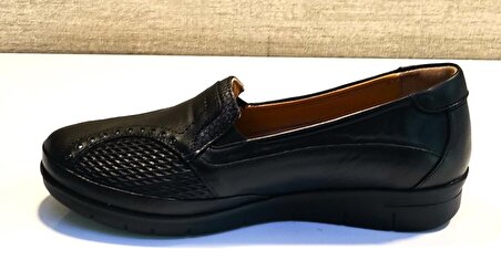 Drzen 241 Bayan Kemik Çıkıntılı Deri Comfort Ayakkabı Siyah
