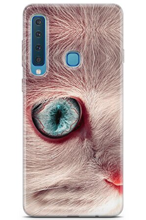 Samsung Galaxy A9 2018 Uyumlu Kılıf Opus 25 Kedi Gözü Soyulmayan Kılıf Skin