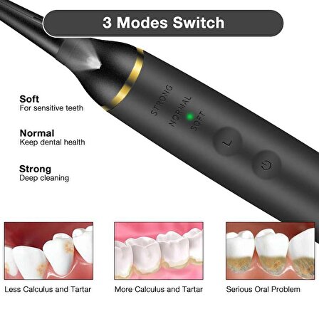 Valkyrie Ultrasonik Taşınabilir Diş Taşı Diş Lekesi Tartar Temizleyici