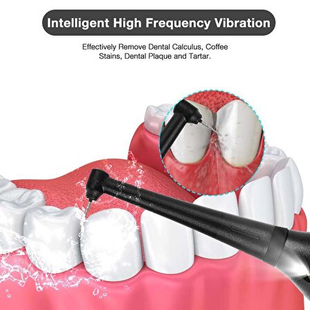 Valkyrie Ultrasonik Taşınabilir Diş Taşı Diş Lekesi Tartar Temizleyici