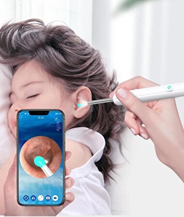 Kameralı Şarjlı Kulak Temizleme Cihazı ( İos ve Android Uyumlu )