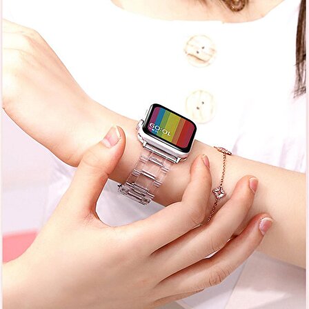 E2M Apple Watch Uyumlu 42-44mm KRD-22 Candy Toz Pembe Kor 