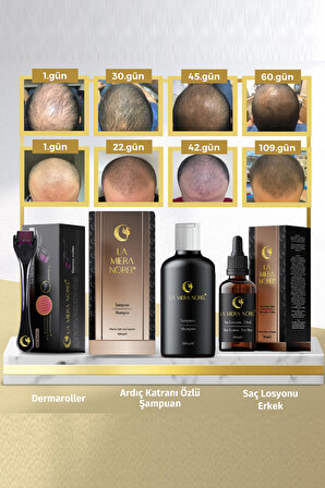  Kampanyalı Başlangıç Paketi - Erkek Saç Bakım Serumu - Dökülme Önleyici Şampuan - Dermaroller