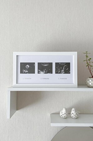 Üçlü Ultrason Anı Çerçevesi - Gebelikte Bebeğin Gelişimini Üç Trimester Anı Olarak Saklayın