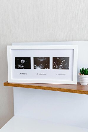 Üçlü Ultrason Anı Çerçevesi - Gebelikte Bebeğin Gelişimini Üç Trimester Anı Olarak Saklayın