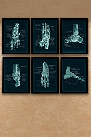 Dekor Loft Anatomik Tablo, Doktor Hediyesi, Ortopedi, Ayak Kemikleri, Doktor Odası  Duvar Tablosu 6 lı