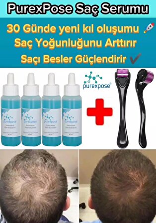 purexpose saç çıkarıcı ve besleyici 4adet 1dermaroller hediyeli