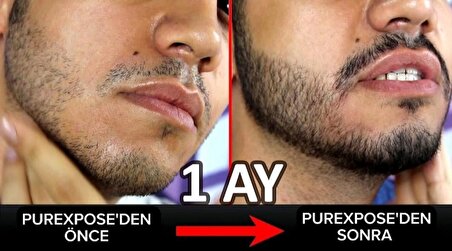 purexpose sakal çıkaran serum 1adet