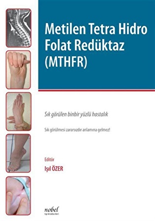 Metilen Tetra Hidro Folat Redüktaz (MTHFR)