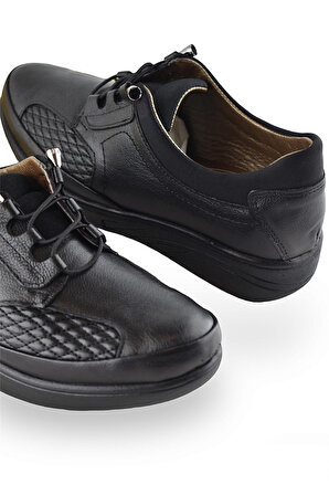 402 TAM ORTOPEDİK Taban Günlük Siyah KOMPLE Hakiki Deri Kadın Ayakkabı 