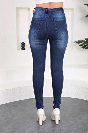 Lacivert Tırnak Detaylı Yüksek Bel Likralı Denim Pantolon