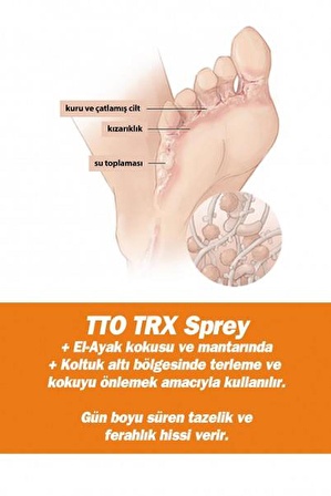 Tto Thermal Terex Ter Önleyici Sprey 50 Ml